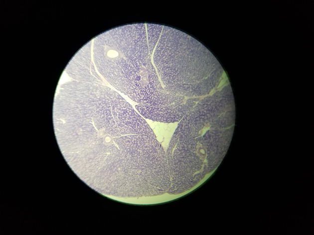 Pancreas Slides - Pancreas 006 40X